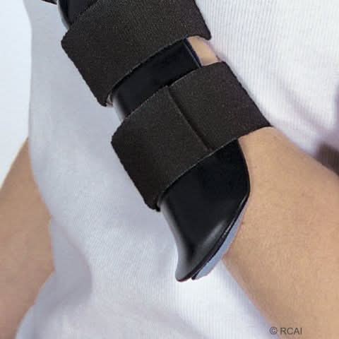 Black RCAI dorsal resting hand orthosis with finger separators secured by two wide adjustable straps, worn on left wrist,.