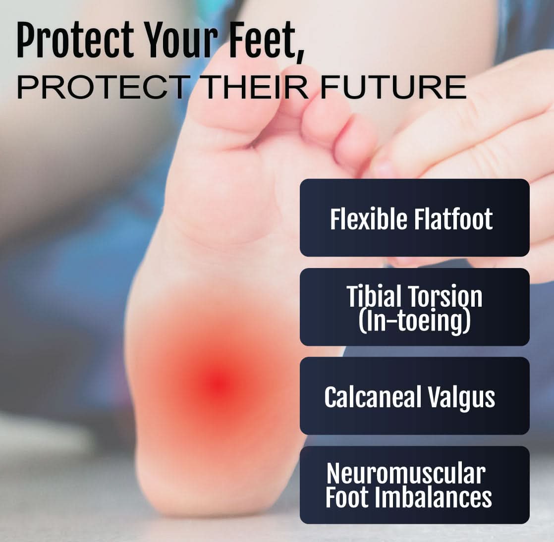 Close-up of a baby’s sole with red highlighting on heel area showing conditions like flexible flatfoot and tibial torsion,.