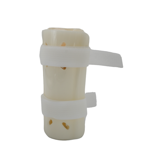 Pediatric forearm fracture orthosis in white plastic with adjustable white straps, made in the USA, RCAI best orthopedic.