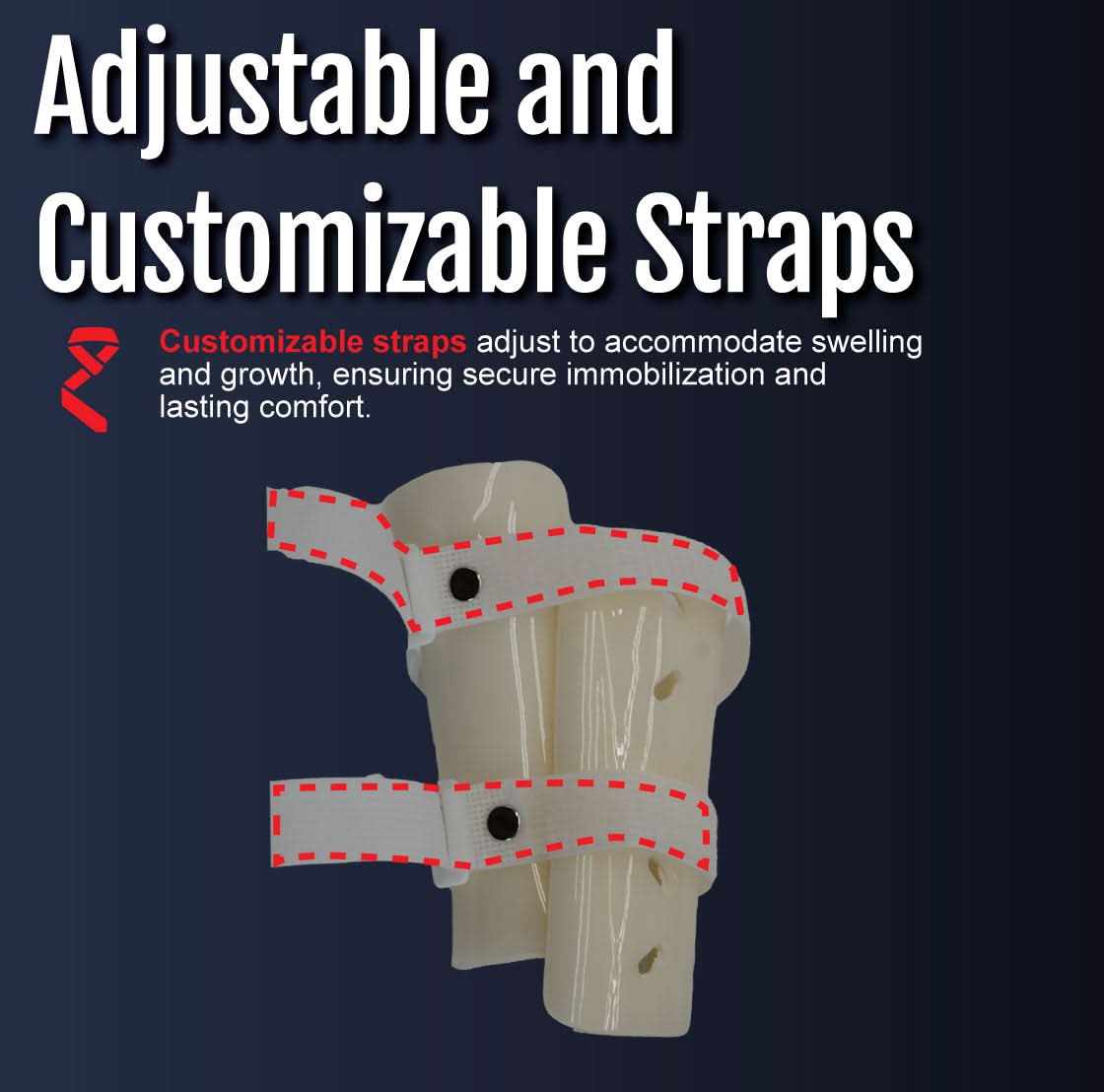 Pediatric forearm fracture orthosis with beige molded shell and two adjustable customizable straps, secured by black snap.